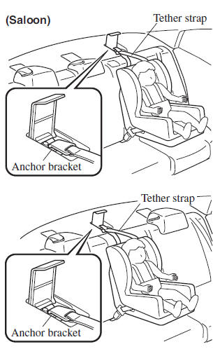 Anchor bracket location